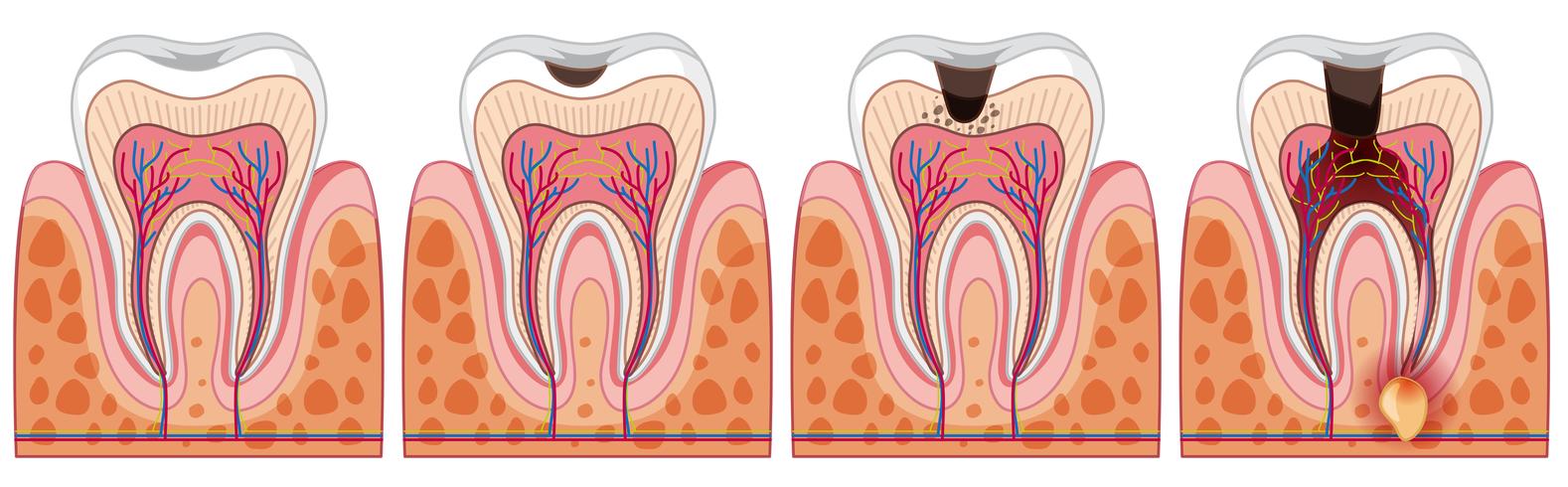 Eine Reihe von menschlichen Zahn vektor