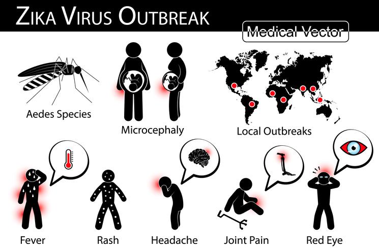 Zika-Virus bricht Infografiken aus. Moskito. Aedes-Arten. ist Träger, Mikrozephalie beim Fötus, lokaler Ausbruch, Symptom des Zikafiebers. vektor