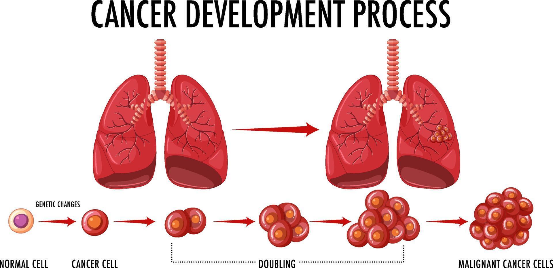 cancerutveckling process infographic vektor