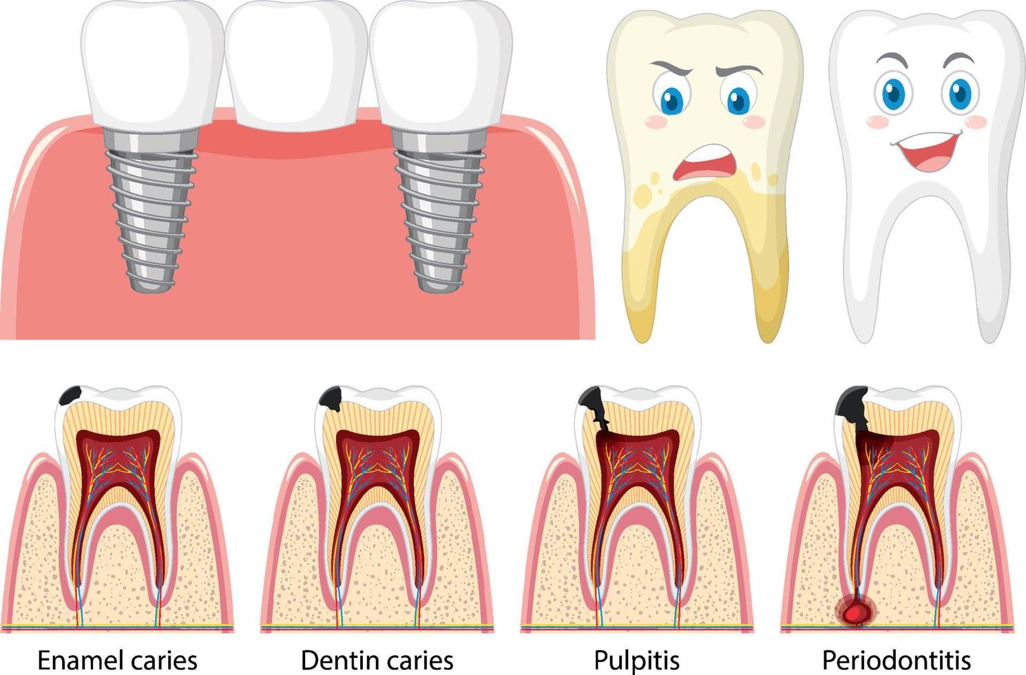 Satz aller Arten von Zähnen auf weißem Hintergrund vektor