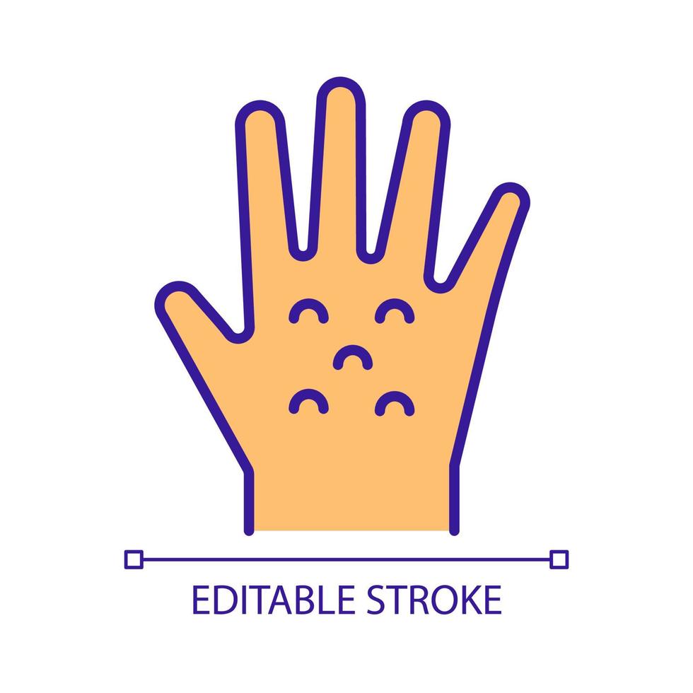 allergisk reaktion på händerna rgb färgikon. handutslag. kontaktdermatit. irriterande hudreaktioner. kroppsinfektioner. isolerade vektor illustration. enkel fylld linjeritning. redigerbar linje