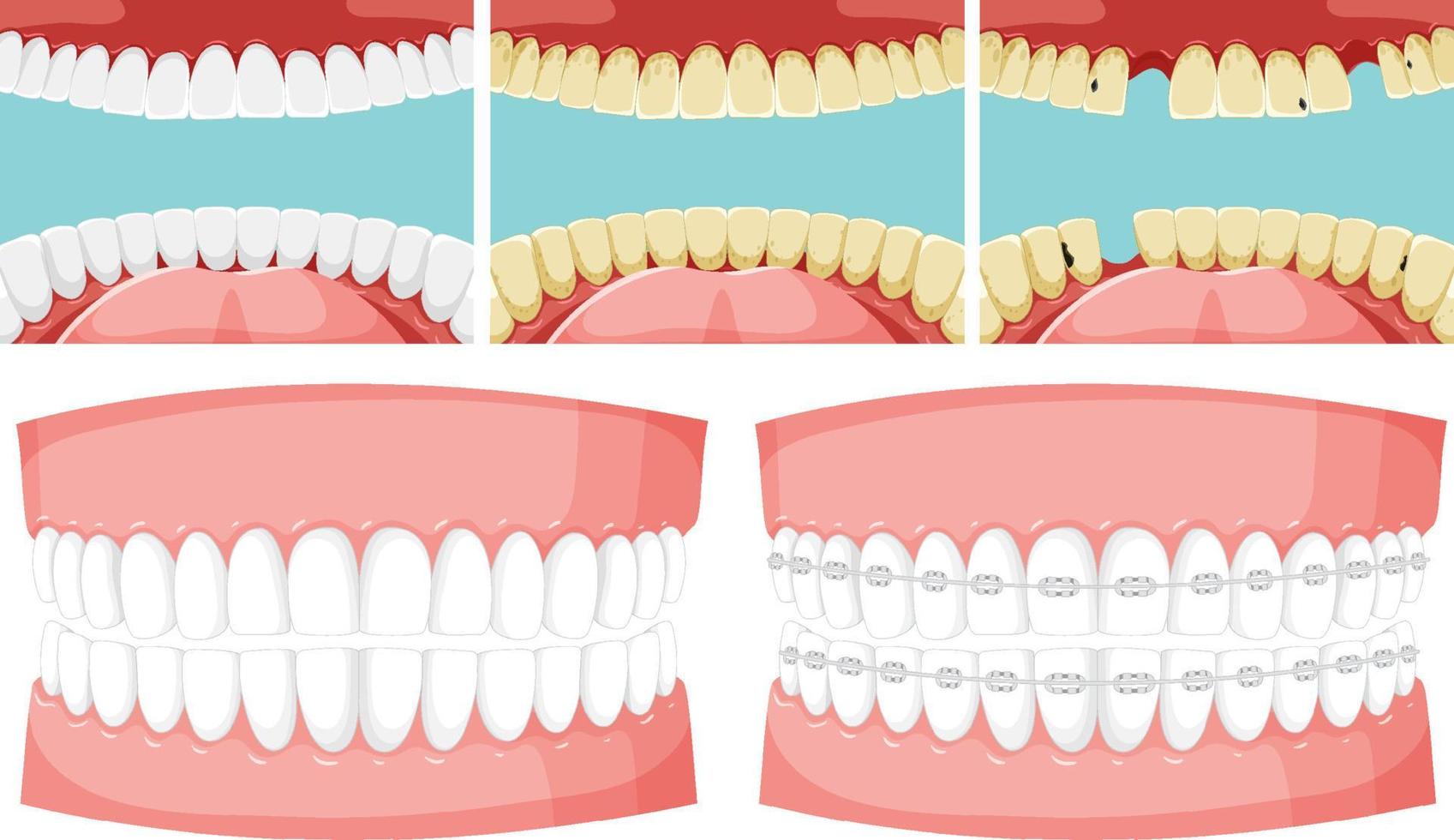 Satz von Zähnen im menschlichen Mund mit menschlichem Zahnmodell vektor