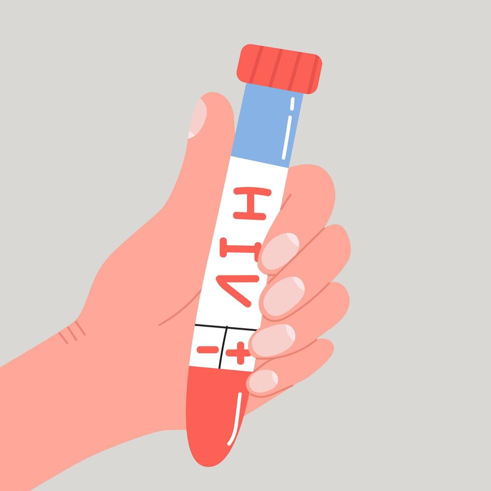handhåll provrör med blod för hiv aids-test. modern platt vektor isolerad illustration i trendiga färger