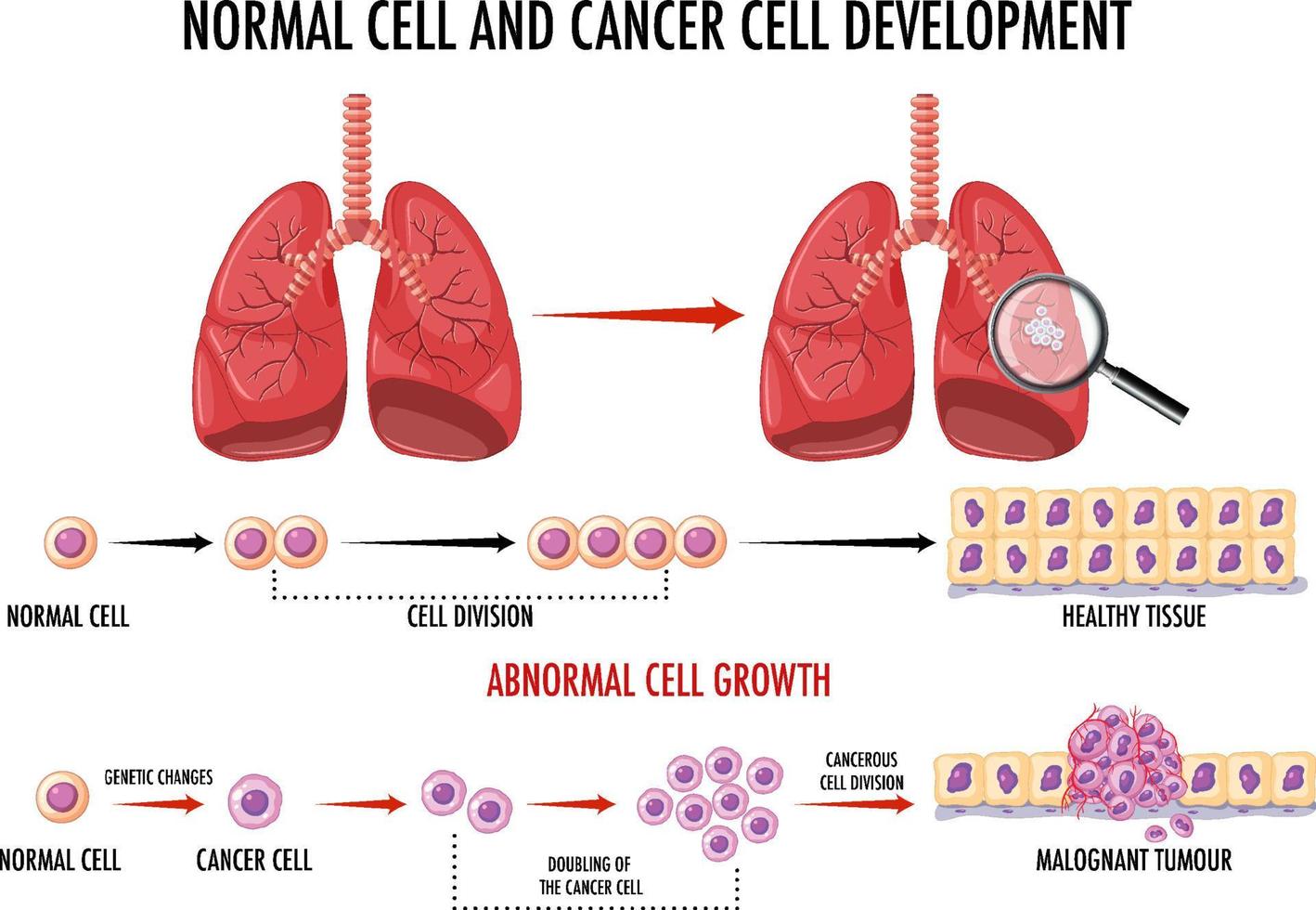 diagram som visar normala celler och cancerceller vektor