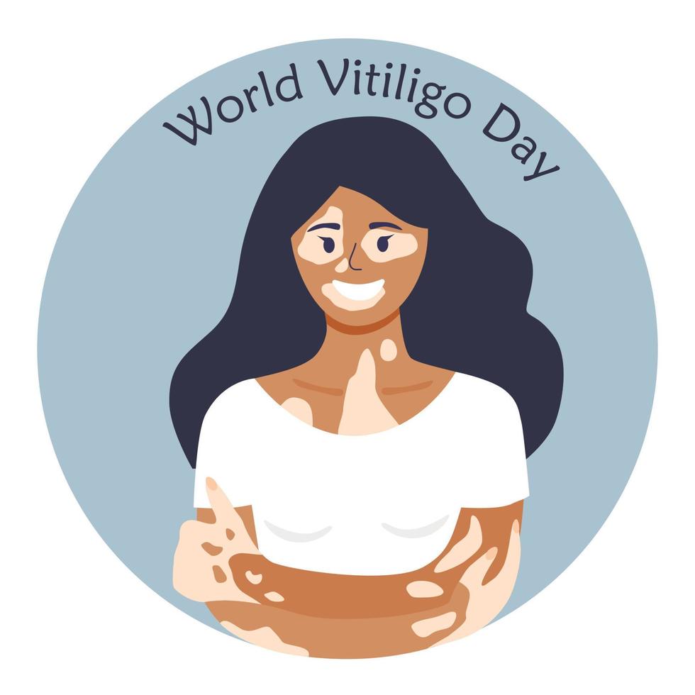 das hübsche Mädchen mit Hautkrankheit. Welt-Vitiligo-Tag. Depigmentierungsproblem. menschliche Solidarität. vektor