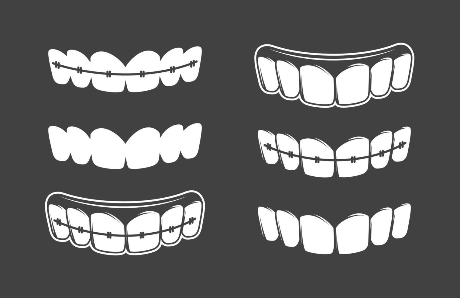 Satz Zähne isoliert auf schwarzem Hintergrund vektor