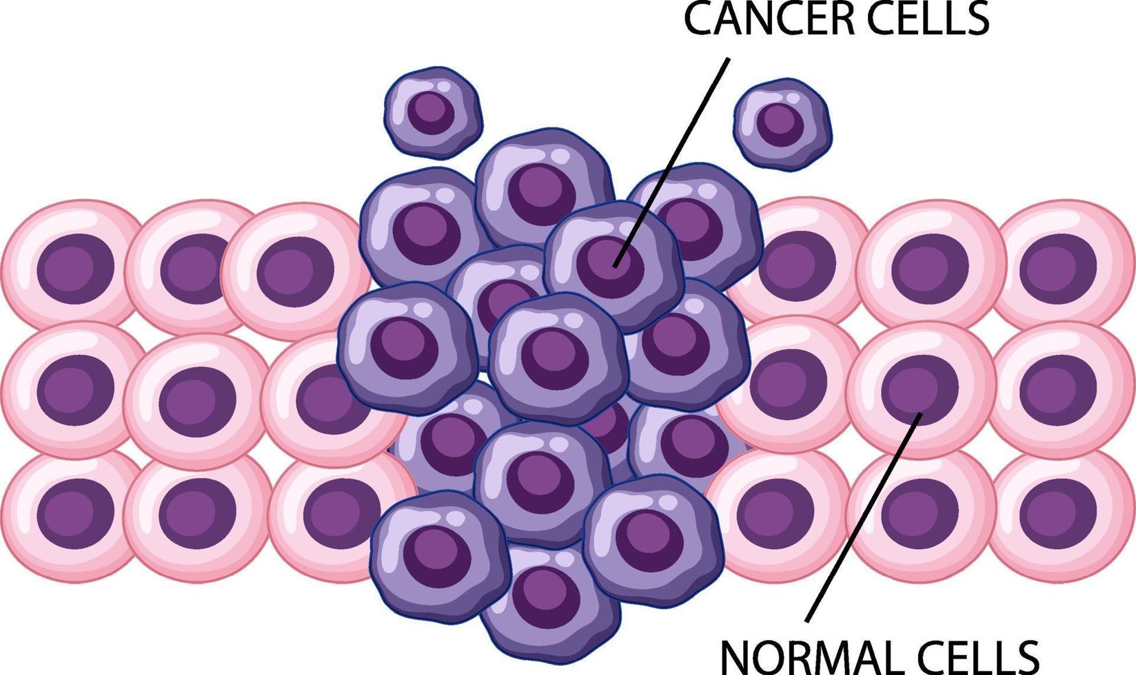 utvecklingsprocessen för cancerceller vektor