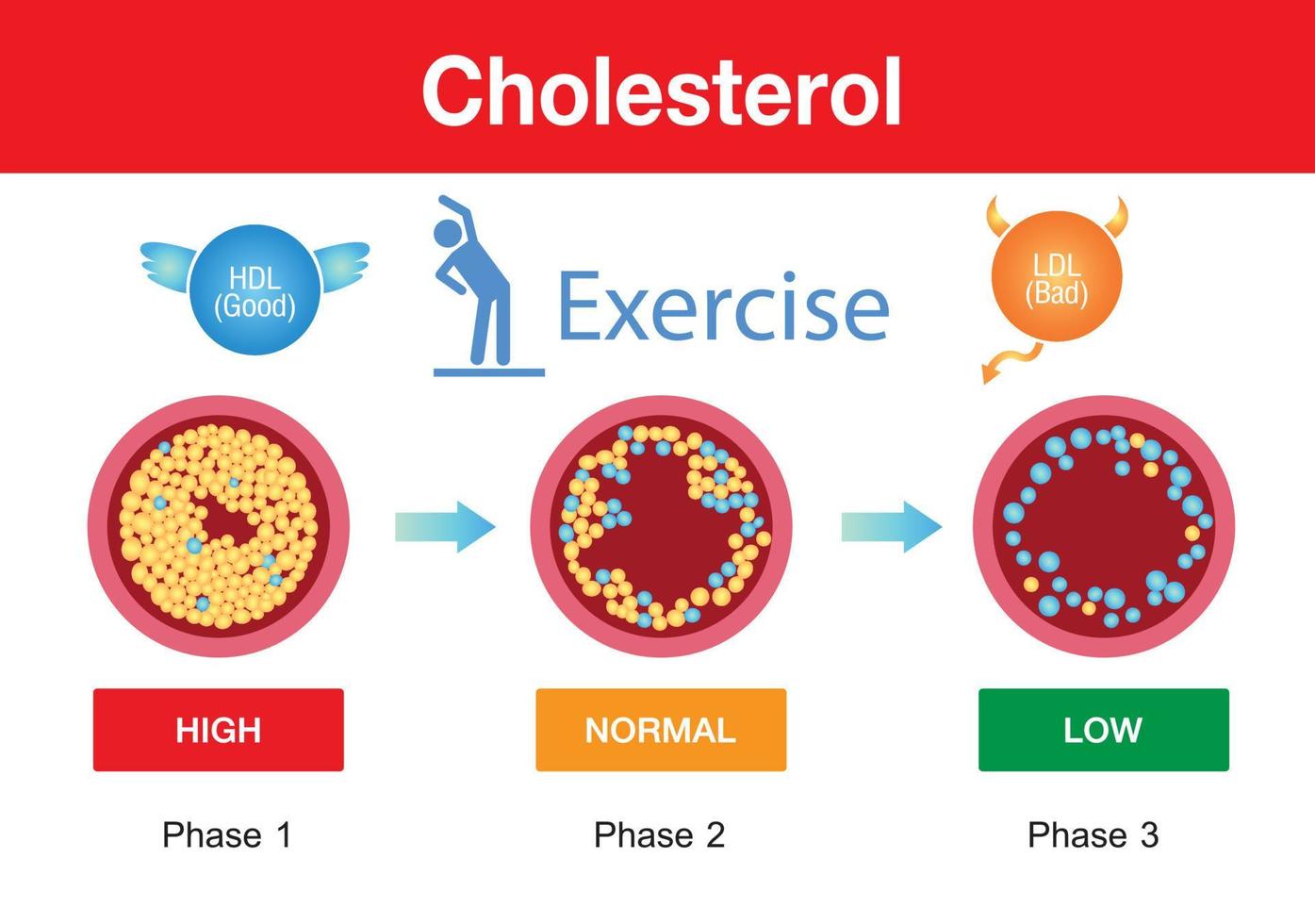 kolesterol i artären, hälsorisk, träning, vektordesign vektor