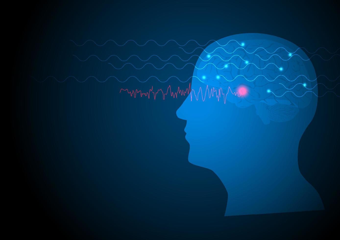 vektor illustration av mänskliga eeg anfall från tinningloben