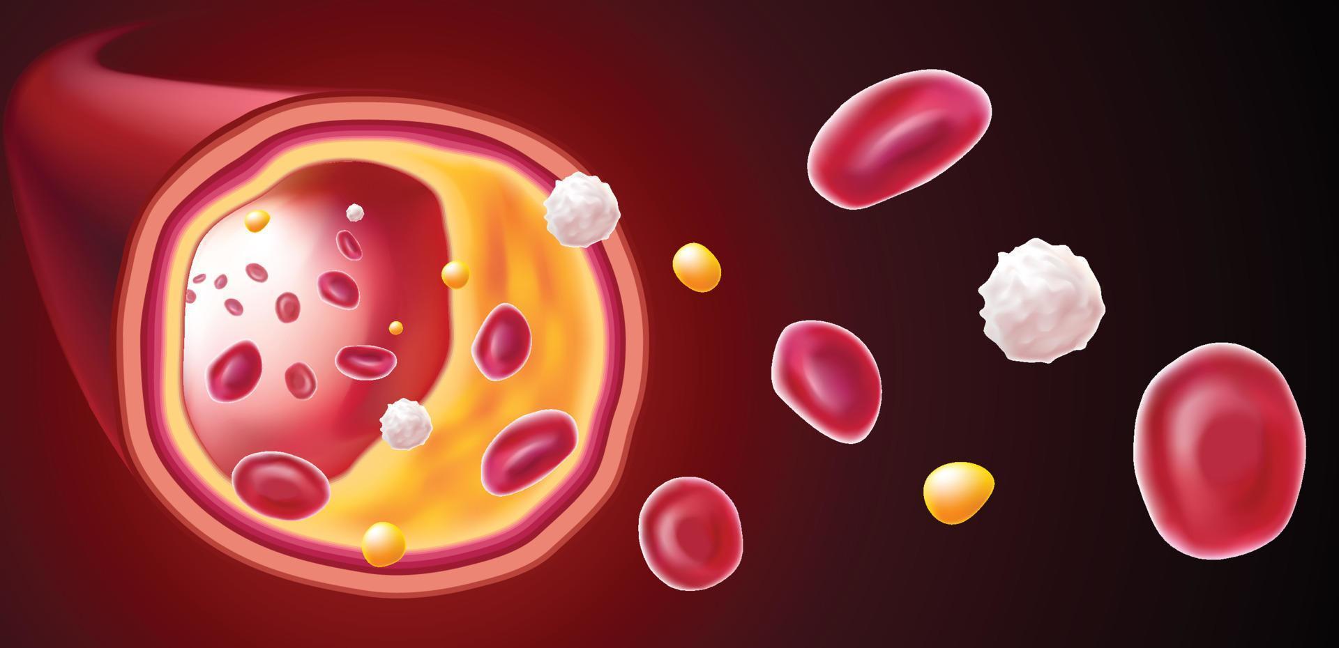 3D-illustration av röda blodkroppar, vita blodkroppar och kolesterol som täpper till dödsorsaken. vektor