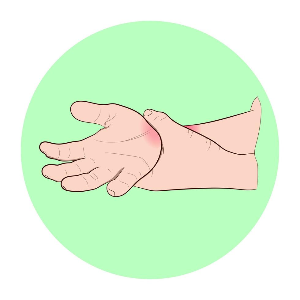 Bildgrafiken Vektorskizze Schmerzen im Handgelenk werden oft durch Verstauchungen oder Frakturen durch plötzliche Verletzungen verursacht Konzept Gesundheitsversorgung vektor