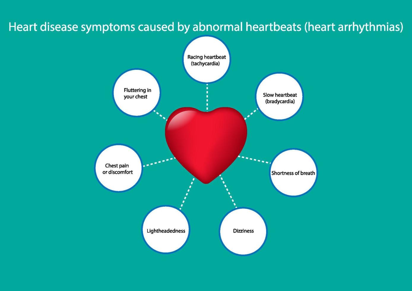 grafik ritning koncept hjärtsjukdom symptom orsakade av onormala hjärtslag, vektorillustration vektor