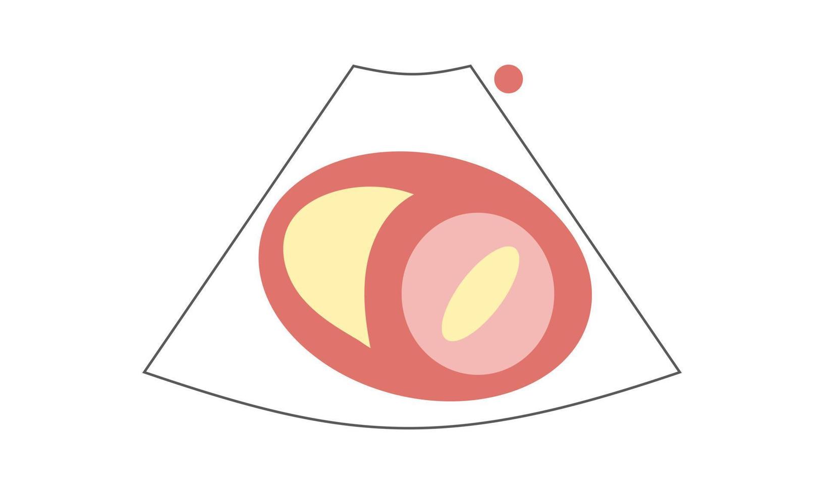 diagram av parasternal kortaxelvy vid mitralisklaffen av ekokardiografi. sjukvård koncept vektor