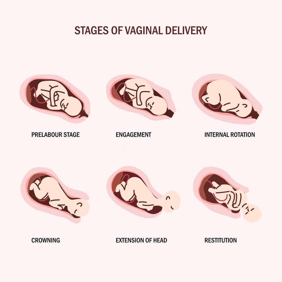 stadium der vaginalen entbindung flache illustration vektor