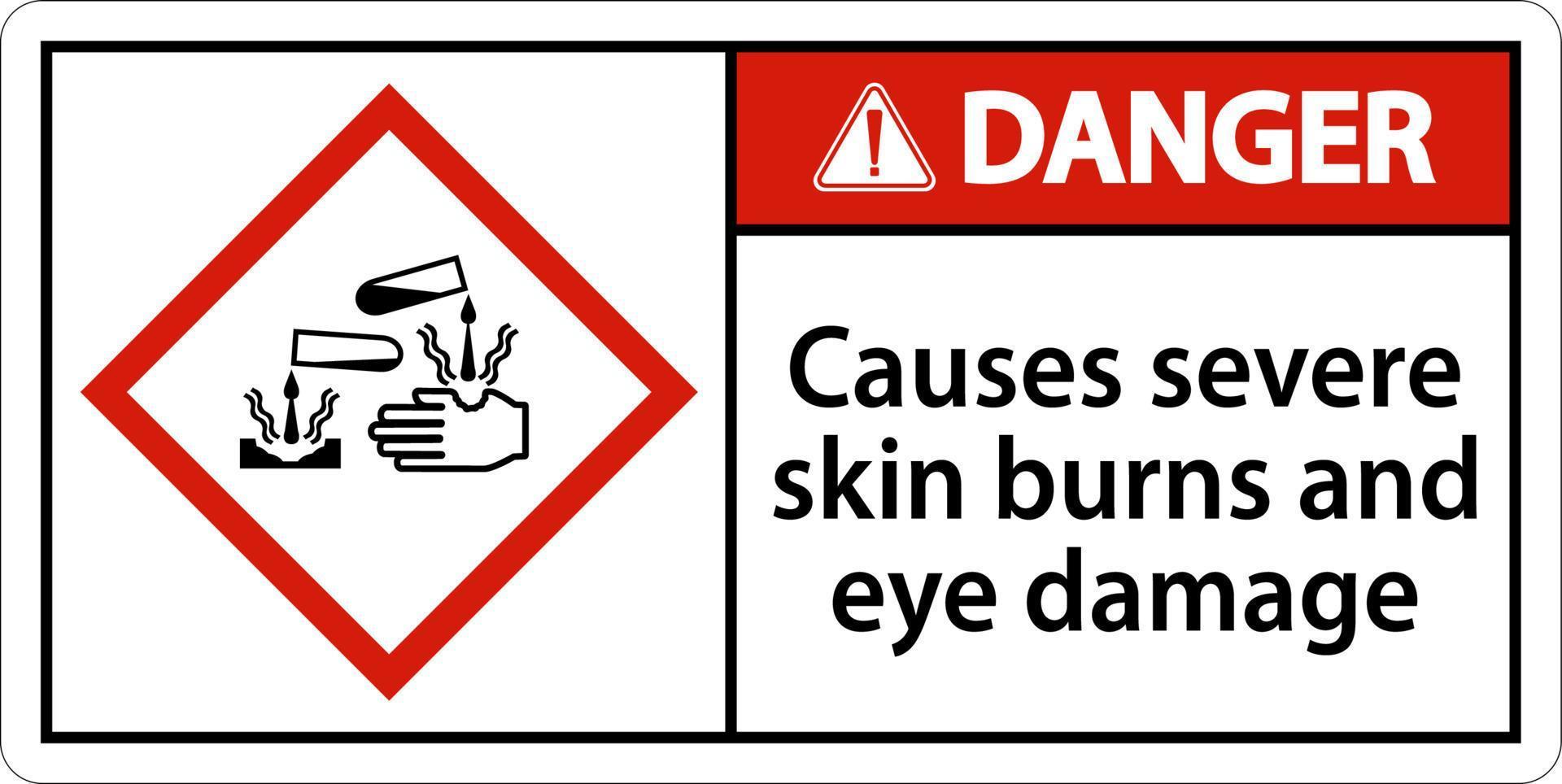 fara orsakar allvarliga brännskador på huden ögonskador ghs tecken vektor
