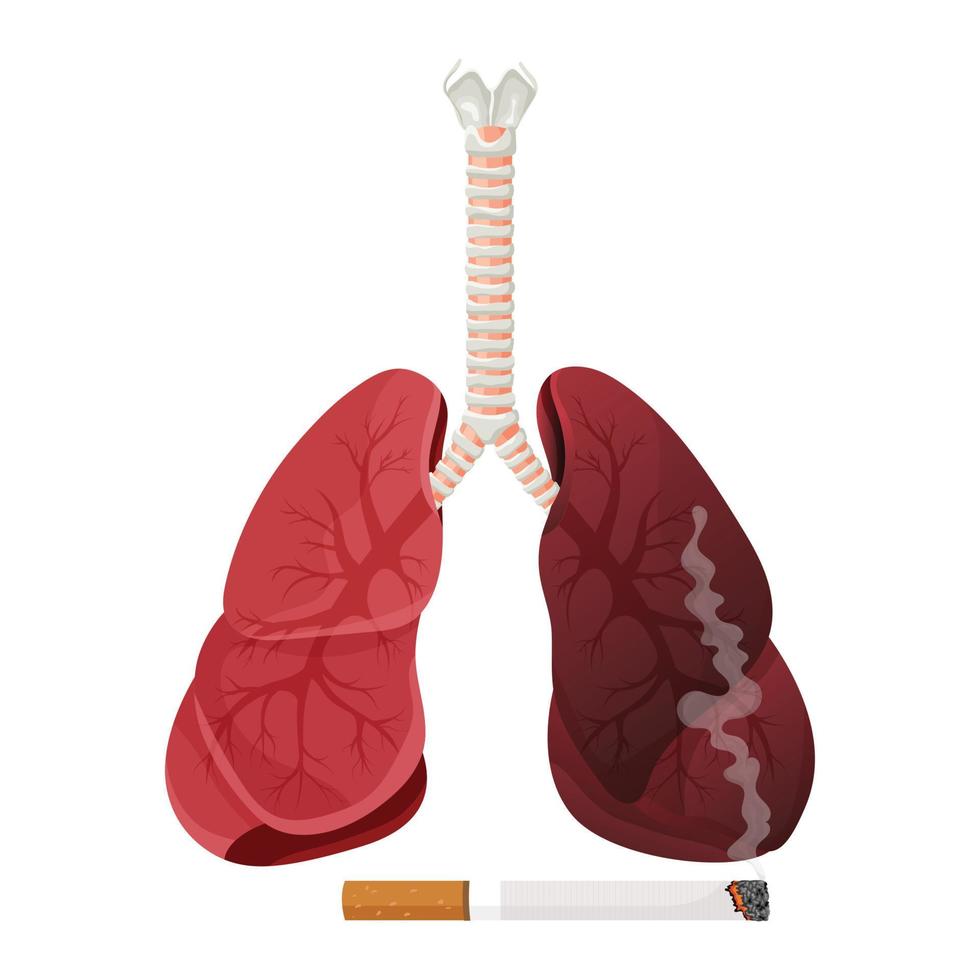 illustration av normala friska lungor och lungor rökare. begreppet sluta röka. vektor illustration.