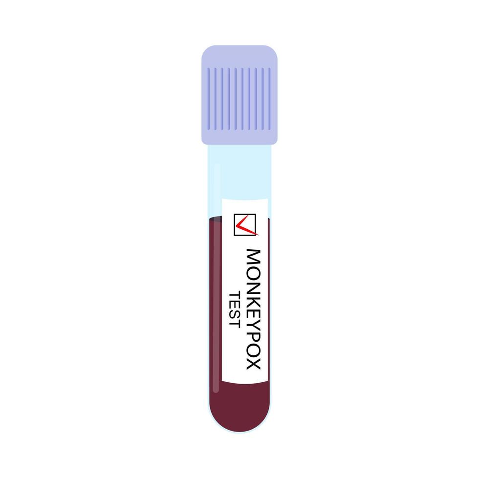 Reagenzglas mit einer Blutprobe mit einem positiven Test auf Affenpockenvirus Nahaufnahme isoliert auf weißem Hintergrund. Vektor-Illustration. vektor