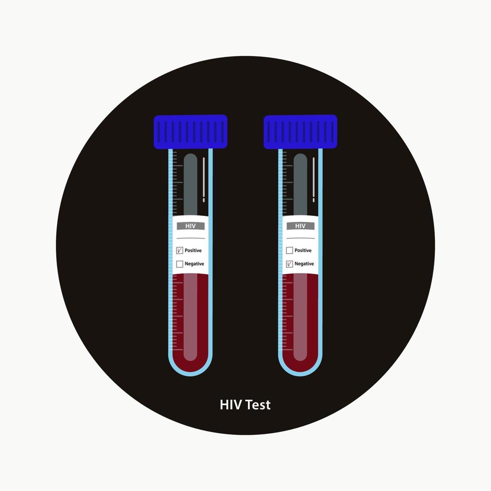 hiv-bluttests in röhrchen mit positiver und negativer etikettenvektorillustration vektor