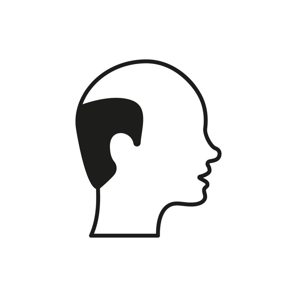 haarlose männliche schwarze Ikone. glatzköpfiger Mann Silhouette Piktogramm. Haarausfall, Symbol für medizinisches Problem der Alopezie. isolierte vektorillustration. vektor