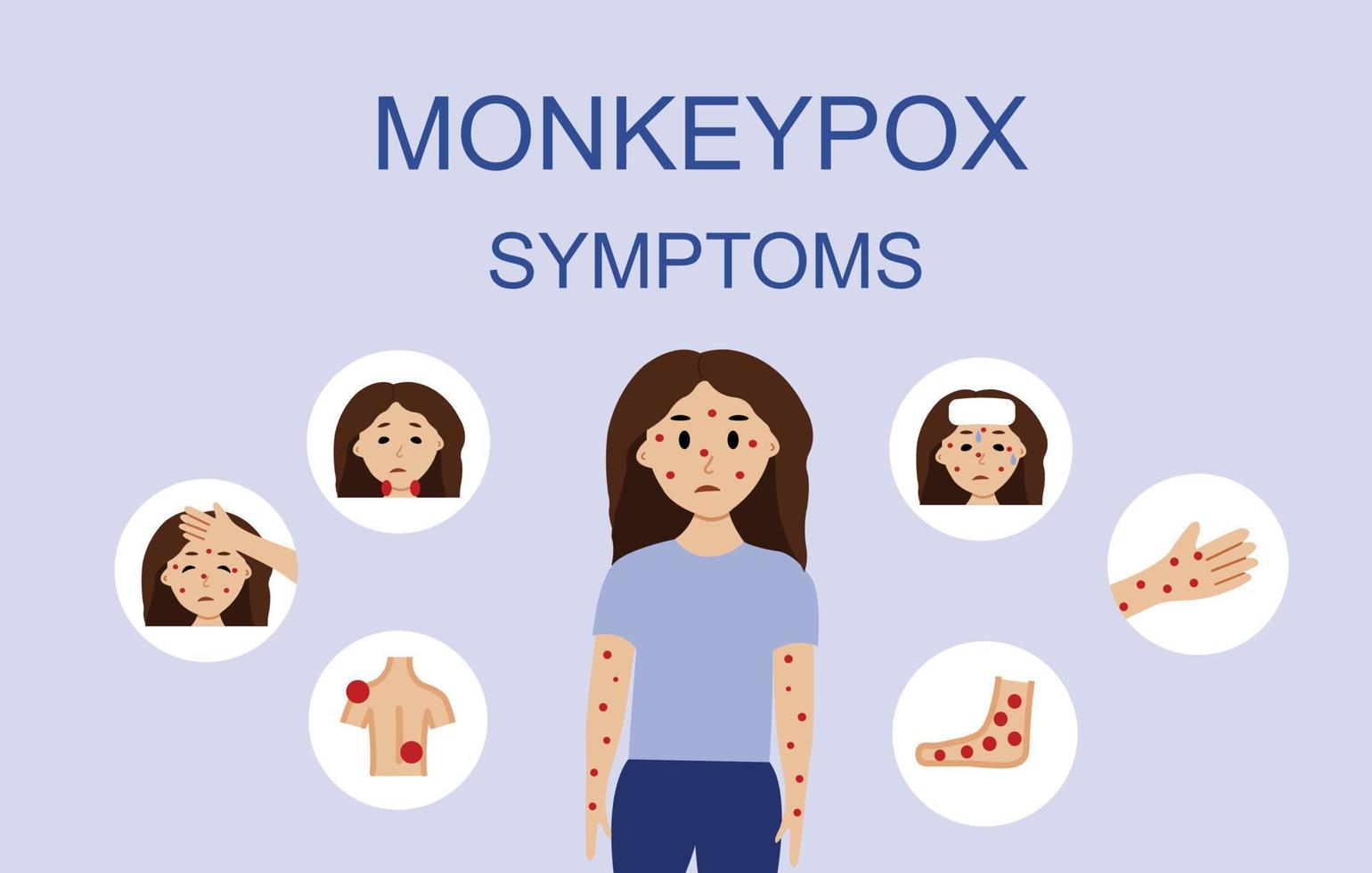 Abbildung der Symptome des Affenpockenvirus mit weiblichem Charakter. Affenpocken-Ausbruchskonzept der Weltgesundheitsorganisation mit Beispielen und Erläuterungen. vektor