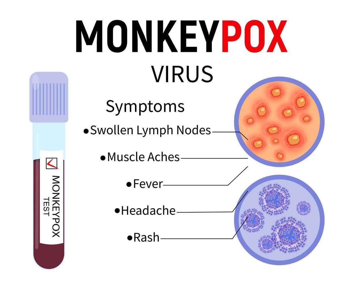 reagenzglas mit blut für affenpockenvirustest, menschliche hautprobe mit ausschlag und viruszellen auf weißem hintergrund. Symptome von Affenpocken. Vektor-Illustration. vektor