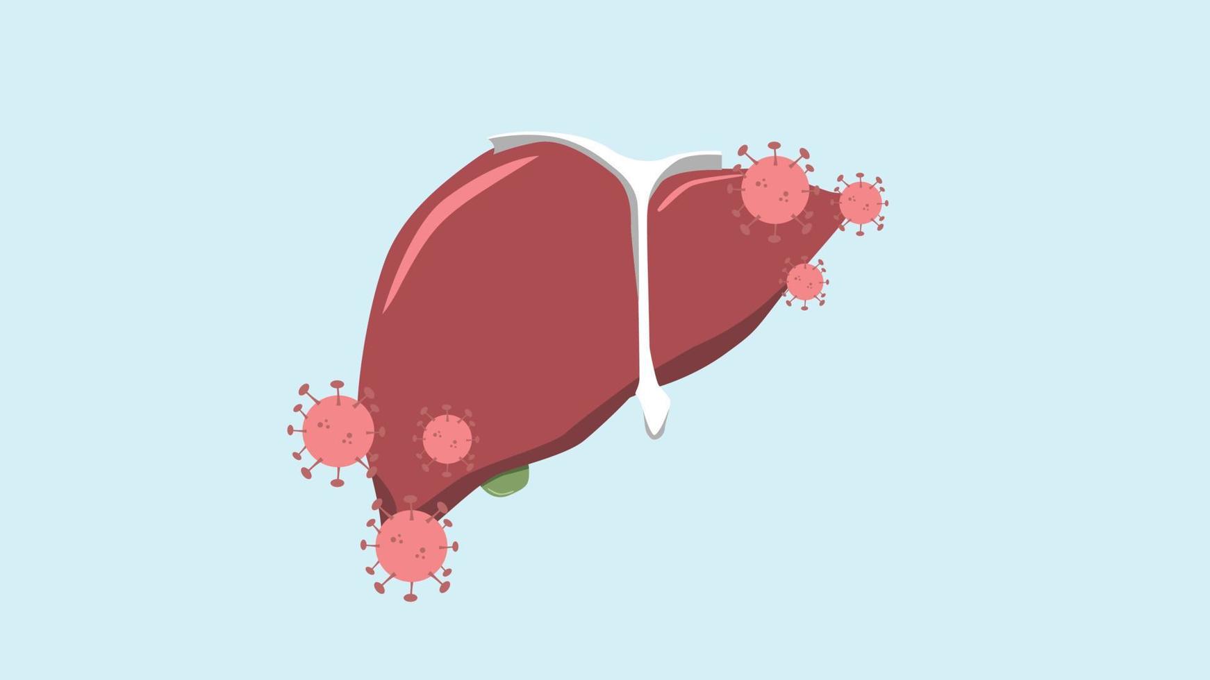 Herzleber mit Hepatitis-Virus-Hepatitis vektor