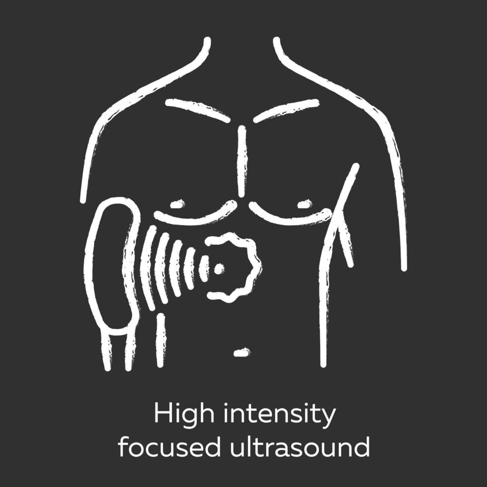 hög intensitet fokuserad ultraljud krita ikon. hifu. icke-invasiv terapeutisk teknik. behandling med ultraljudsvågor. förstör vävnad genom intensiv värme. isolerade svarta tavlan vektorillustration vektor
