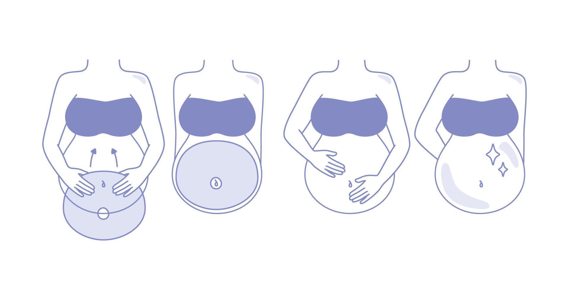 Schritt der Anwendung Hautpflege Bauchmaske Spa für schwangere Mütter zur Vorbeugung von Falten vektor