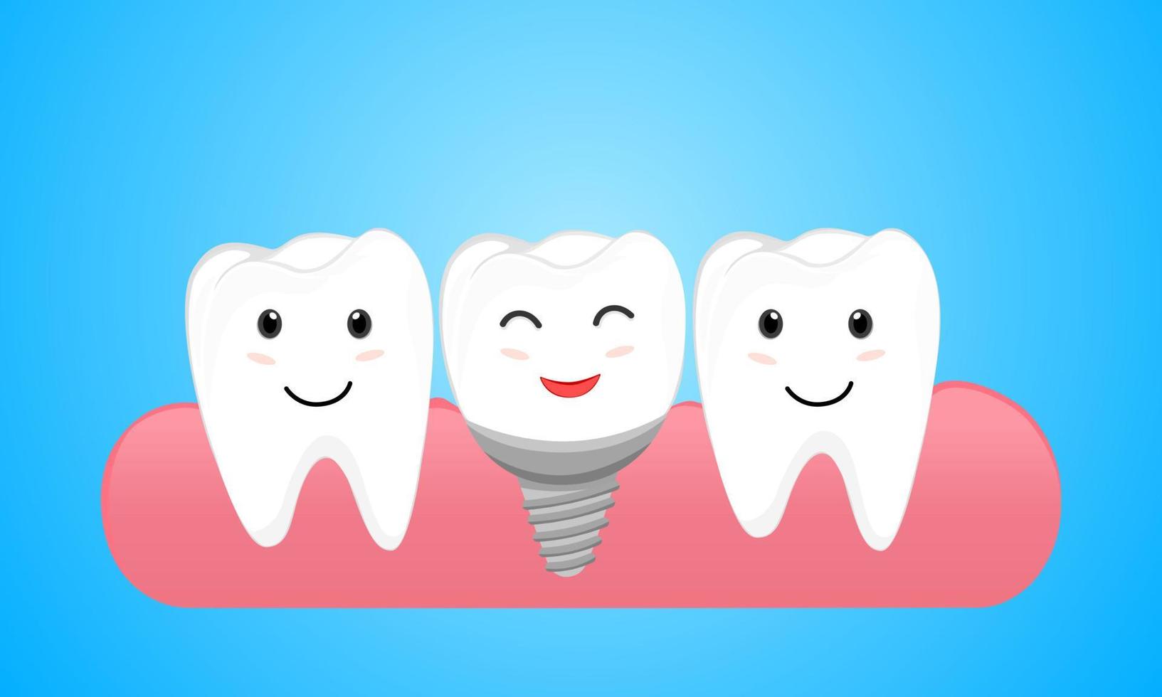 tandimplantat och normal tand. tandimplantatskruv i tandköttet vektor
