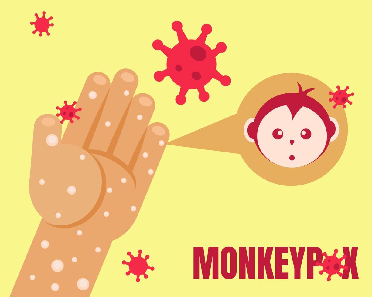 Monkeypox utbrott koncept. händer med virus. tecknad vektor stil för din design.