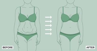 Fett zu passen. Vor und nach der Gewichtsabnahme fette und schlanke Frau auf einer hellen Hintergrundvektorillustration. Fetter und dünner weiblicher Körper.