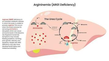 Abbildung des Arginase-Arginase-Arg1-Mangel-Vektordiagramms vektor