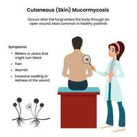 kutan mukormykos vektor illustration informativa grafisk