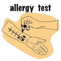 Allergietest. der arzt hält die pipette zur untersuchung in der hand. handfläche nach oben, hautallergietest durchführen. für medizinische Website, Werbung für Medikamente. Patient mit einer allergischen Reaktion. vektor
