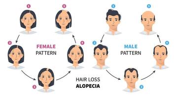 hår förlust etapper, androgenetiska alopeci manlig och kvinna mönster. steg av skallighet vektor cirkel infographic i en platt stil med en man och en kvinna. ändring de hårfäste på de skalp