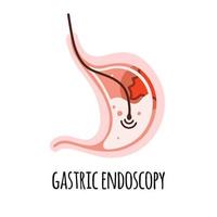 Endoskopie. der Magen einer Person mit einem Geschwür. Gastroenterologie. vektorillustration in einem flachen stil. vektor