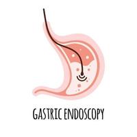 Endoskopie. der Magen eines gesunden Menschen. Gastroenterologie. vektorillustration in einem flachen stil. vektor