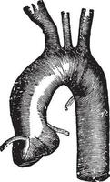 bröstkorg aorta, årgång illustration. vektor