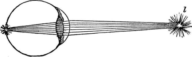 refraktion förbi de öga, årgång illustration. vektor