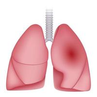 lunginflammation sjukdom lungor ikon, realistisk stil vektor
