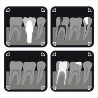 tand röntgen illustration, friska tänder, tandläkare vektor illustration, oral vård
