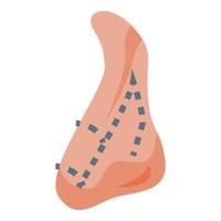 Rhinoplastik-Symbol isometrischer Vektor. Nasenoperation vektor