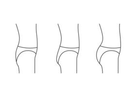 Arten von Hintern Frau, Form Gesäßseite, Liniensymbol. Augmentation, Gesäß von klein, flach in voller Beute umformen. kosmetische medizinische Eingriffe, Klinik für plastische Chirurgie. Vektor-Umriss-Illustration vektor