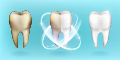 sauberer und schmutziger Zahn, Aufhellung oder Reinigung von Zähnen vektor