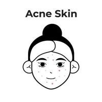 acne hud typ vektor