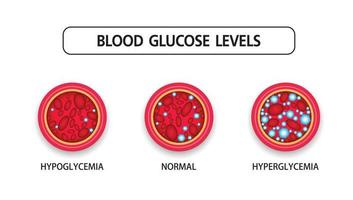 hyperglykemi, högt blodsocker och diabetes, fetma är ett allvarligt medicinskt tillstånd orsakar, vektordesign. vektor