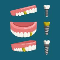 Falsche Zähne mit Schrauben-Vektor-Illustration