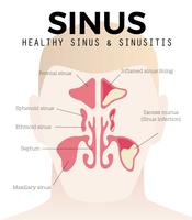 Freie Sinus- und Sinusitis-Vektor vektor