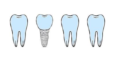 Zahnsymbole. Zeichnung im Skizzenstil. Infografiken in der Zahnmedizin. Vektor-Illustration vektor