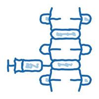 Epiduralanästhesie-Doodle-Symbol handgezeichnete Illustration vektor